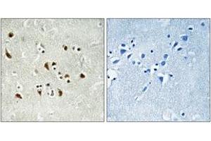 Immunohistochemistry analysis of paraffin-embedded human brain tissue, using TUBGCP6 Antibody. (GCP6 antibody  (AA 741-790))