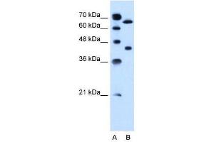 Lane A: Marker Lane B: Jurkat Cell Lysate (SLCO1A2 antibody  (AA 201-250))