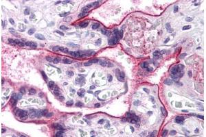 Human Placenta: Formalin-Fixed, Paraffin-Embedded (FFPE) (CDC16 antibody  (N-Term))