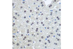 Immunohistochemistry of paraffin-embedded Rat liver using UB antibody (2359) at dilution of 1:100 (40x lens).