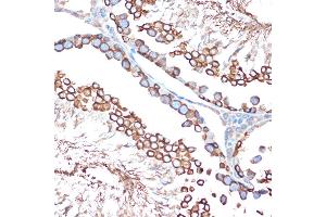 Immunohistochemistry of paraffin-embedded rat testis using B Rabbit mAb (ABIN1678826, ABIN3015929, ABIN3015930 and ABIN7101463) at dilution of 1:100 (40x lens). (Activin A Receptor Type IB/ALK-4 antibody)