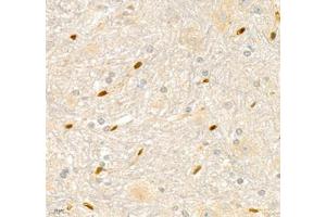 Immunohistochemistry of paraffin embedded mouse spinal cord using ANXA3 (ABIN7073065) at dilution of 1: 200 (400x lens) (Annexin A3 antibody)