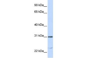 Western Blotting (WB) image for anti-Nucleolar and Spindle Associated Protein 1 (NUSAP1) antibody (ABIN2459000) (NUSAP1 antibody)