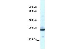 WB Suggested Anti-PGAM1 Antibody Titration: 1.