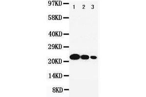 Anti-IL6 antibody, Western blotting Lane 1: Recombinant Human IL-6 Protein 10ng Lane 2: Recombinant Human IL-6 Protein 5ng Lane 3: Recombinant Human IL-6 Protein 2. (IL-6 antibody  (C-Term))