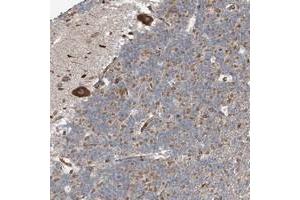 Immunohistochemical staining of human cerebellum with C2orf30 polyclonal antibody  shows strong cytoplasmic positivity in Purkinje cells.