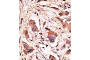 Image no. 1 for anti-Melanoma Antigen Family D, 1 (MAGED1) (Middle Region) antibody (ABIN358657) (MAGED1 antibody  (Middle Region))