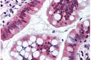 Human Small Intestine (formalin-fixed, paraffin-embedded) stained with SRI antibody ABIN290232 at 10 ug/ml followed by biotinylated goat anti-rabbit IgG secondary antibody ABIN481713, alkaline phosphatase-streptavidin and chromogen. (SRI antibody  (AA 50-100))