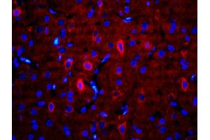 Formalin-fixed and paraffin-embedded rat brain labeled with Anti-RALDH2 Polyclonal Antibody, Unconjugatedused at 1:200 dilution for 40 minutes at 37°C. (ALDH1A2 antibody  (AA 441-518))