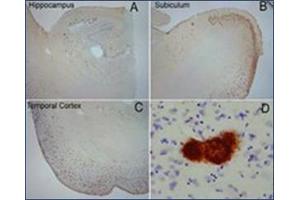 Extensive OC labeling was observed in the hippocampus (A), subiculum (B) and frontal cortex (C) in Alzheimer disease. (Amyloid Fibrils antibody)