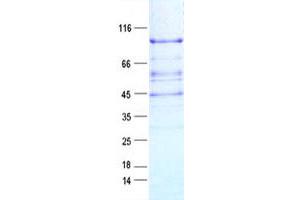 APLF Protein (DYKDDDDK Tag)