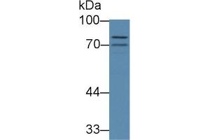 Western Blot; Sample: Mouse Cerebrum lysate; Primary Ab: 1µg/ml Rabbit Anti-Mouse ABCB8 Antibody Second Ab: 0. (ABCB8 antibody  (AA 468-717))
