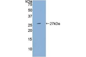 Detection of Recombinant PSG1, Human using Polyclonal Antibody to Pregnancy Specific Beta-1-Glycoprotein 1 (PSG1)