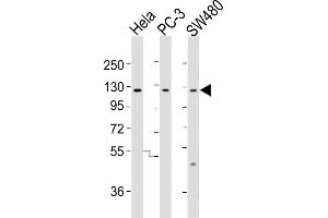 All lanes : Anti-SLCO1B3 Antibody (C-term) at 1:2000 dilution Lane 1: Hela whole cell lysates Lane 2: PC-3 whole cell lysates Lane 3: S whole cell lysates Lysates/proteins at 20 μg per lane. (SLCO1B3 antibody  (C-Term))