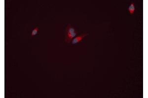 ABIN6277813 staining HEPG2 cells by ICC/IF. (GLUL antibody  (C-Term))