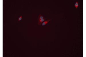 ABIN6277813 staining HEPG2 cells by ICC/IF.