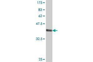 Western Blot detection against Immunogen (37 KDa) . (STXBP5 antibody  (AA 1017-1115))