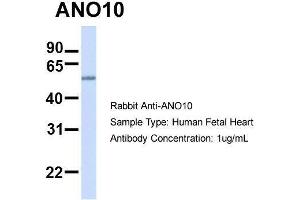 Hum. (Anoctamin 10 antibody  (C-Term))