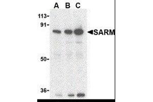 Western Blotting (WB) image for anti-Sterile alpha and TIR Motif Containing 1 (SARM1) (C-Term) antibody (ABIN2476424) (SARM1 antibody  (C-Term))