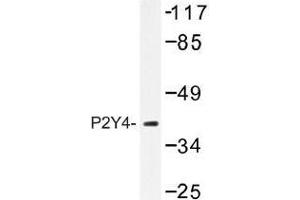 Image no. 1 for anti-Pyrimidinergic Receptor P2Y, G-Protein Coupled, 4 (P2RY4) antibody (ABIN317768) (P2RY4 antibody)