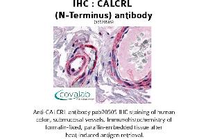 Image no. 1 for anti-Calcitonin Receptor-Like (CALCRL) (Extracellular Domain), (N-Term) antibody (ABIN1732561)