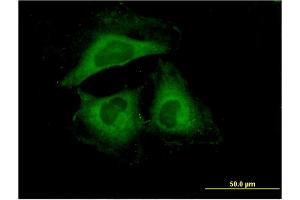 Immunofluorescence of monoclonal antibody to HSPB6 on HeLa cell. (HSPB6 antibody  (AA 1-160))
