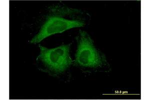 Immunofluorescence of monoclonal antibody to HSPB6 on HeLa cell. (HSPB6 antibody  (AA 1-160))