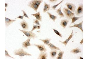 Immunohistochemistry (IHC) image for anti-Caveolin 1, Caveolae Protein, 22kDa (CAV1) (AA 4-178) antibody (ABIN3043803)