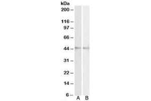 Western blot testing of mouse [A] and rat [B] eye lysates with RNF13 antibody at 2ug/ml.