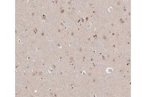 ABIN6266665 at 1/100 staining human brain tissue sections by IHC-P. (TRADD antibody)
