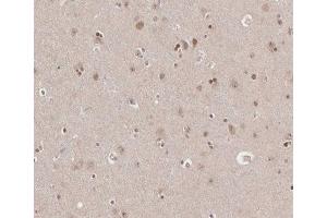 ABIN6266665 at 1/100 staining human brain tissue sections by IHC-P. (TRADD antibody)