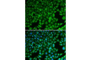 Immunofluorescence analysis of U2OS cells using NDRG1 antibody (ABIN5971169). (NDRG1 antibody)