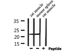 Western blot analysis of extracts from rat muscle,mouse spleen, using PRDX2 Antibody.