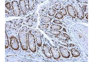 Immunohistochemistry (IHC) image for anti-High Mobility Group Box 1 (HMGB1) antibody (ABIN2854997)