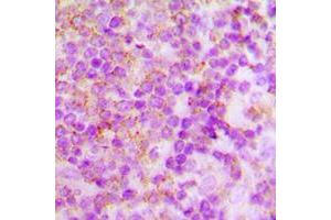 Immunohistochemical analysis of p40 phox staining in human tonsil formalin fixed paraffin embedded tissue section. (NCF4 antibody  (Center))