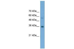 WB Suggested Anti-GALE Antibody Titration: 0. (GALE antibody  (Middle Region))