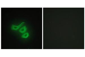 Immunofluorescence analysis of HepG2 cells, using M-CK antibody.