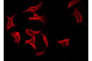 ABIN6269034 staining Hela by IF/ICC. (TNFAIP6 antibody  (N-Term))