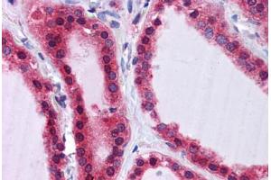 Human Thyroid: Formalin-Fixed, Paraffin-Embedded (FFPE) (SCRN2 antibody  (C-Term))
