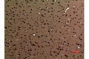 Immunohistochemistry (IHC) analysis of paraffin-embedded Rat Brain, antibody was diluted at 1:100. (Myosin VI antibody  (N-Term))