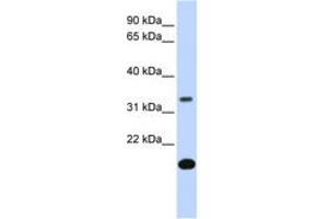 Image no. 1 for anti-Follistatin (FST) (AA 144-193) antibody (ABIN6743094) (Follistatin antibody  (AA 144-193))