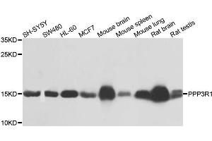 Western blot analysis of extracts of various cells, using PPP3R1 antibody. (PPP3R1 antibody)