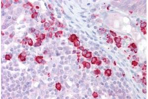 Anti-DAK antibody IHC staining of human tonsil. (DAK antibody  (N-Term))