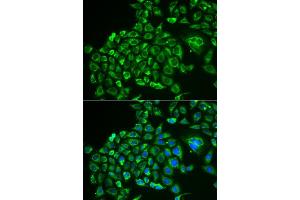 Immunofluorescence analysis of MCF-7 cells using RCVRN antibody (ABIN5973805). (Recoverin antibody)