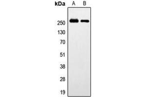 Western blot analysis of GPR179 expression in HeLa (A), SP2/0 (B) whole cell lysates.