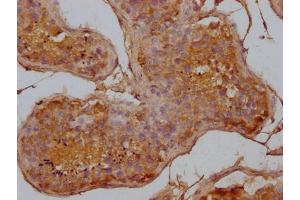IHC image of ABIN7144227 diluted at 1:500 and staining in paraffin-embedded human testis tissue performed on a Leica BondTM system. (ANKRD42 antibody  (AA 158-377))