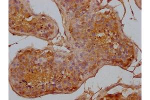 IHC image of ABIN7144227 diluted at 1:500 and staining in paraffin-embedded human testis tissue performed on a Leica BondTM system.