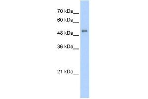 ALAS2 antibody used at 5 ug/ml to detect target protein. (ALAS2 antibody)