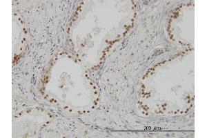 Immunoperoxidase of monoclonal antibody to CLK3 on formalin-fixed paraffin-embedded human prostate. (CLK3 antibody  (AA 36-136))