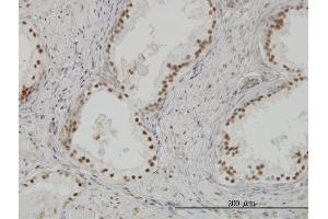 Immunoperoxidase of monoclonal antibody to CLK3 on formalin-fixed paraffin-embedded human prostate. (CLK3 antibody  (AA 36-136))